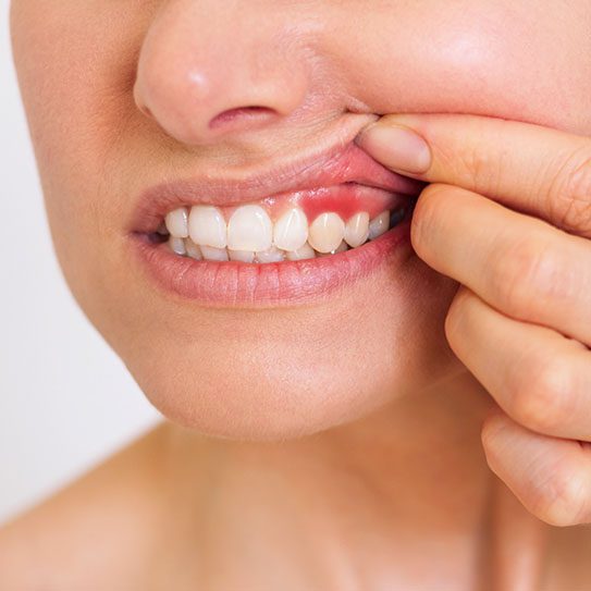 dentist near me gum disease
